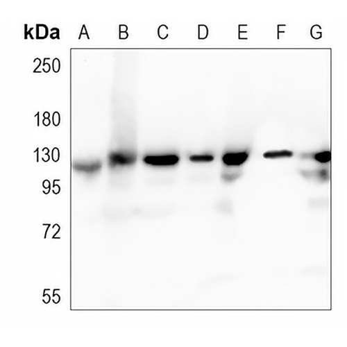 IDE Rabbit Monoclonal Antibody(C1130)