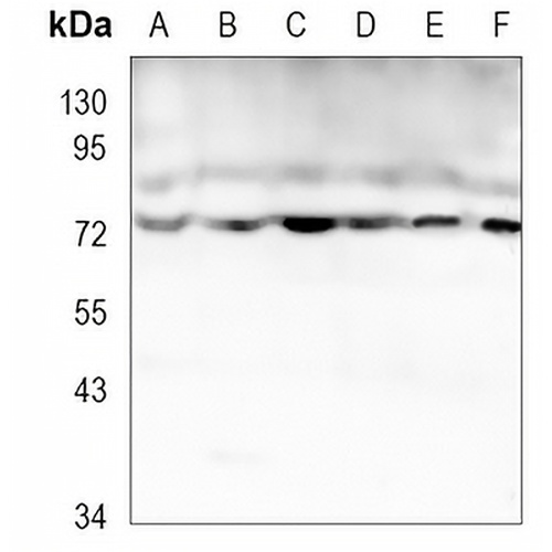 CPT2 Rabbit Monoclonal Antibody(C1133)