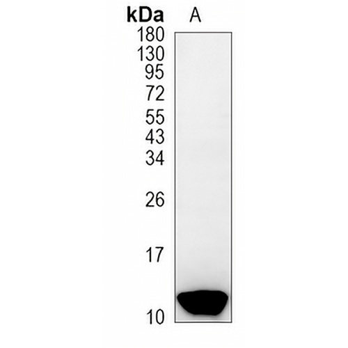 Hemoglobin gamma-1/2 Rabbit Monoclonal Antibody(C1136)