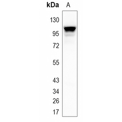 TFR2 Rabbit Monoclonal Antibody(C1138)