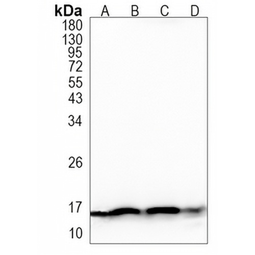 TOM20 Rabbit Monoclonal Antibody(C1142)