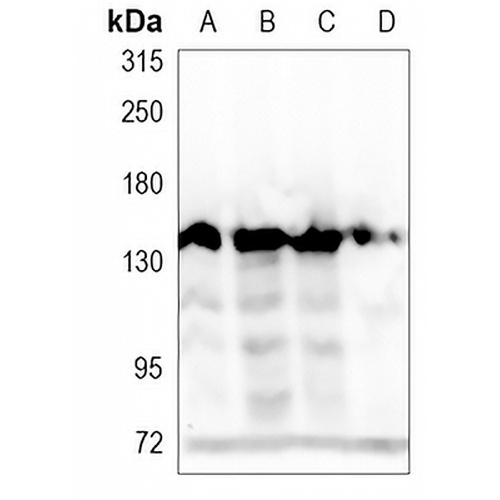 SAP155 Rabbit Monoclonal Antibody(C1143)