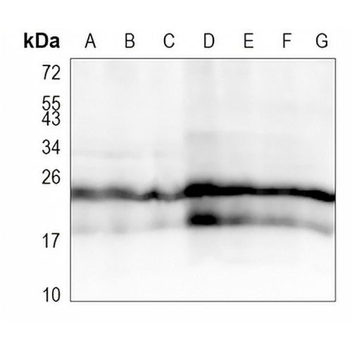 RISP Rabbit Monoclonal Antibody(C1146)