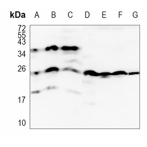 MAD2L2 Rabbit Monoclonal Antibody(C1147)