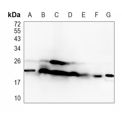 PSMB9 Rabbit Monoclonal Antibody(C1149)