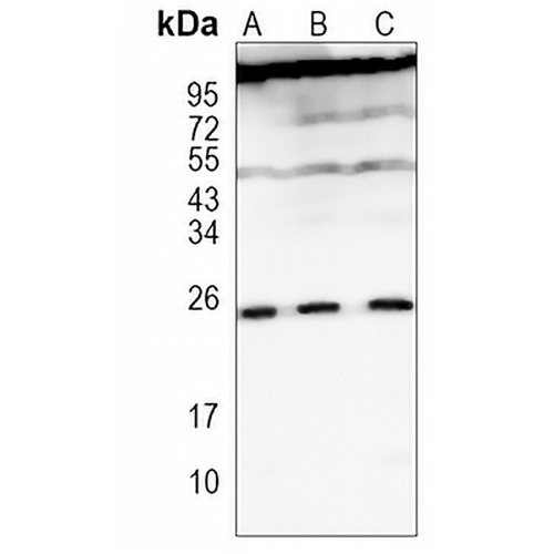 TLF Rabbit Monoclonal Antibody(C1150)