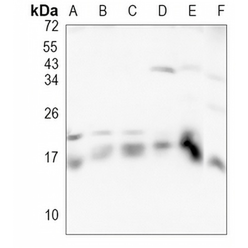 Dynactin 5 Rabbit Monoclonal Antibody(C1153)