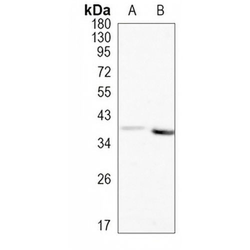 AKR1C1/2 Rabbit Monoclonal Antibody(C1154)