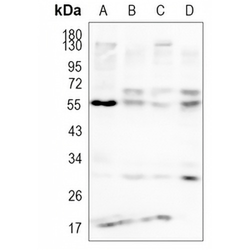 LCAT Rabbit Monoclonal Antibody(C1155)