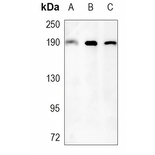 RhoGAP5 Rabbit Monoclonal Antibody(C1157)
