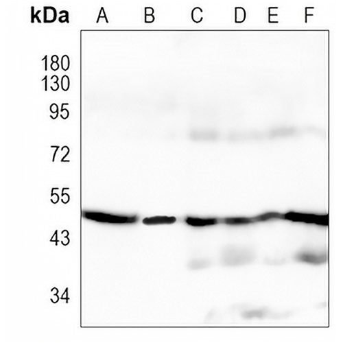 ATP5B Rabbit Monoclonal Antibody(C1158)