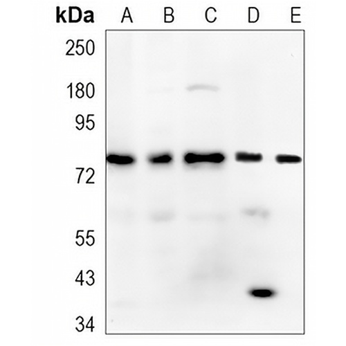 THOC1 Rabbit Monoclonal Antibody(C1159)