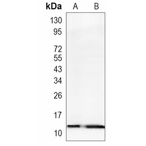 Endobrevin Rabbit Monoclonal Antibody(C1160)