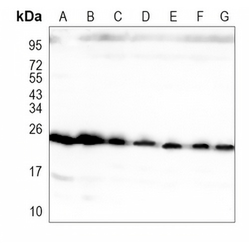 RAB7A Rabbit Monoclonal Antibody(C1161)