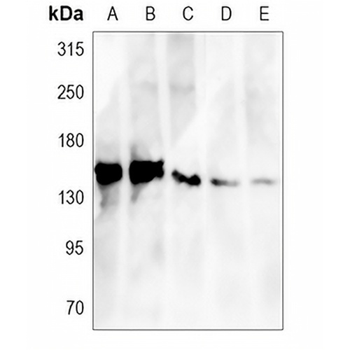 GRP170 Rabbit Monoclonal Antibody(C1162)