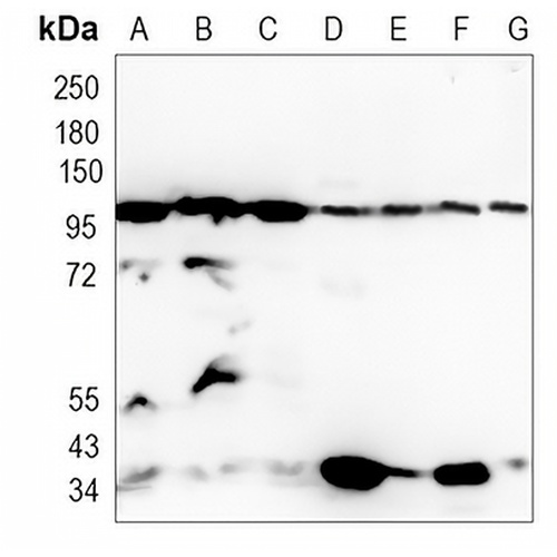 SFPQ Rabbit Monoclonal Antibody(C1163)