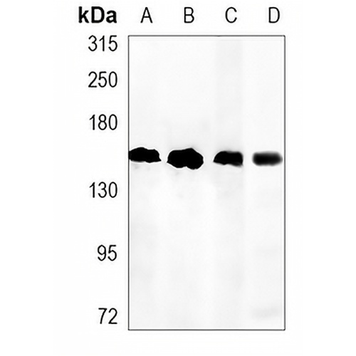 KDM4B Rabbit Monoclonal Antibody(C1164)