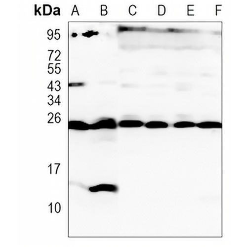 Peroxiredoxin 6 Rabbit Monoclonal Antibody(C1167)
