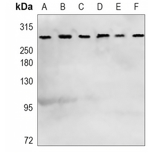 mTOR (Phospho-S2481) Rabbit Monoclonal Antibody(C1169)