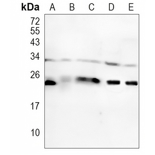 RAB8A Rabbit Monoclonal Antibody(C1170)