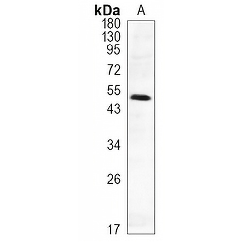 AKT (Phospho-S124) Rabbit Monoclonal Antibody(C1171)