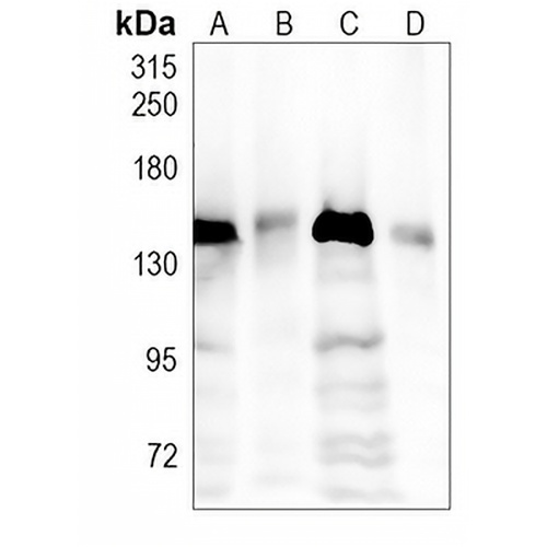 DHX9 Rabbit Monoclonal Antibody(C1172)