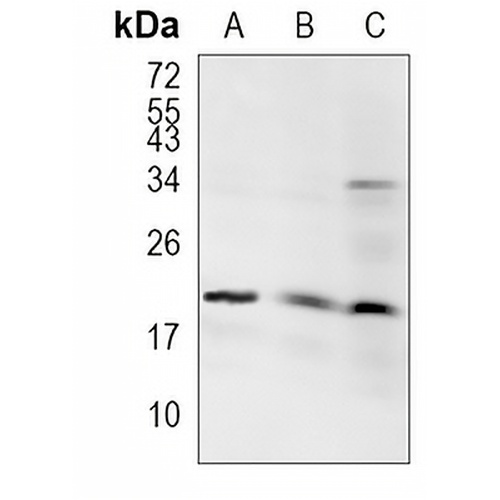 SKP1 Rabbit Monoclonal Antibody(C1173)