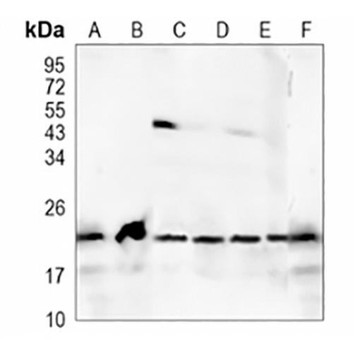 RAB22 Rabbit Monoclonal Antibody(C1174)