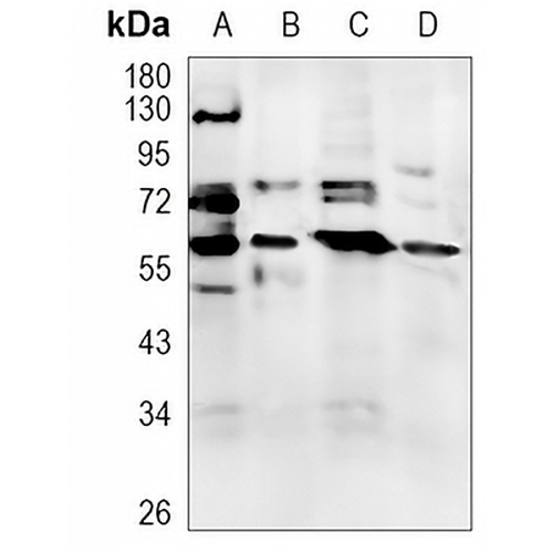 PPP3CA Rabbit Monoclonal Antibody(C1175)