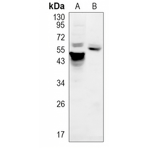 AKT1 Rabbit Monoclonal Antibody(C1176)