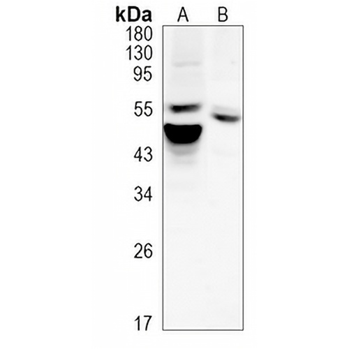 AKT Rabbit Monoclonal Antibody(C1177)