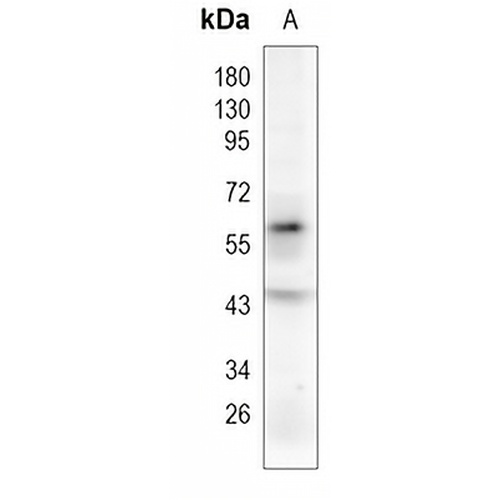 TRAF6 Rabbit Monoclonal Antibody(C1178)