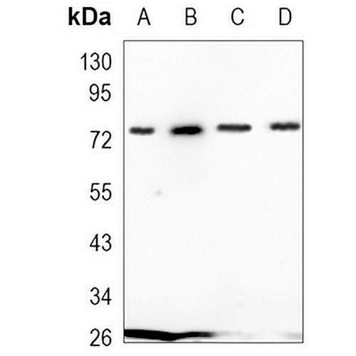 ACAS2 Rabbit Monoclonal Antibody(C1179)