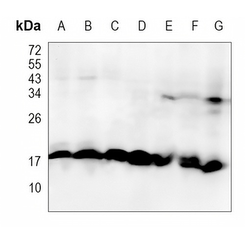 nm23-H2 Rabbit Monoclonal Antibody(C1181)