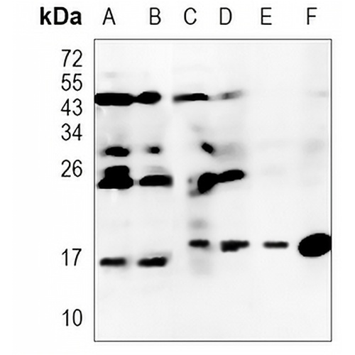 Prefoldin 5 Rabbit Monoclonal Antibody(C1183)