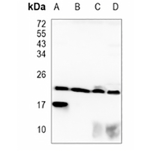 CRCP Rabbit Monoclonal Antibody(C1184)