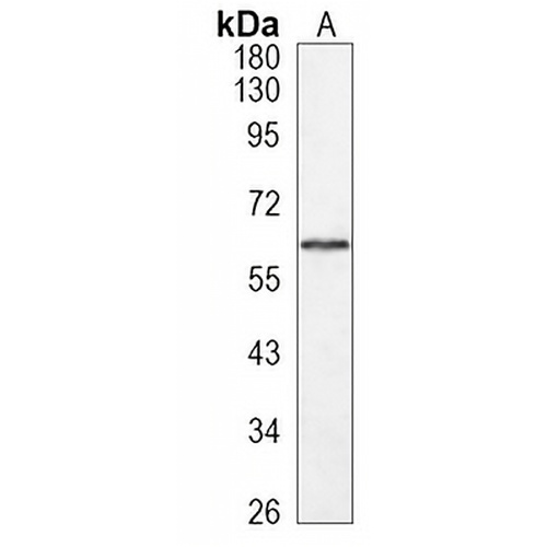 TYRP1 Rabbit Monoclonal Antibody(C1186)
