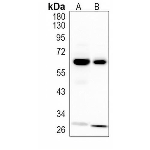 LGI1 Rabbit Monoclonal Antibody(C1187)
