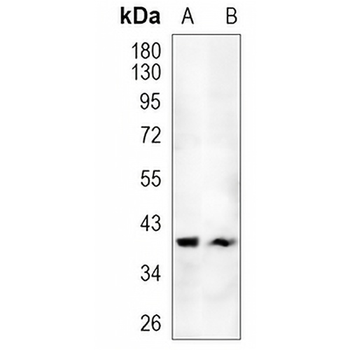 OTX1 Rabbit Monoclonal Antibody(C1188)