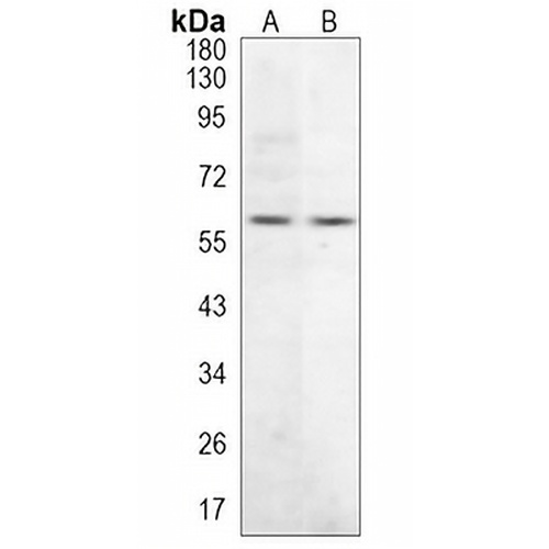 Tyrosine Hydroxylase Rabbit Monoclonal Antibody(C1190)