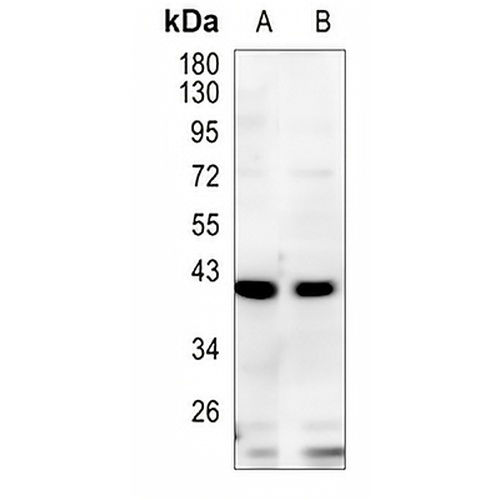 TMOD2 Rabbit Monoclonal Antibody(C1194)