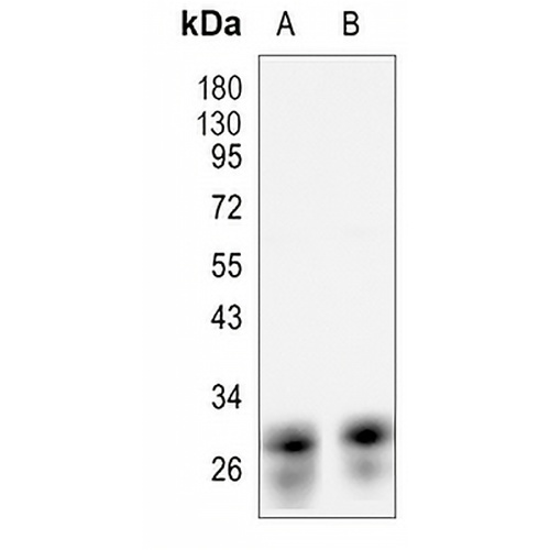 CD230 Rabbit Monoclonal Antibody(C1195)
