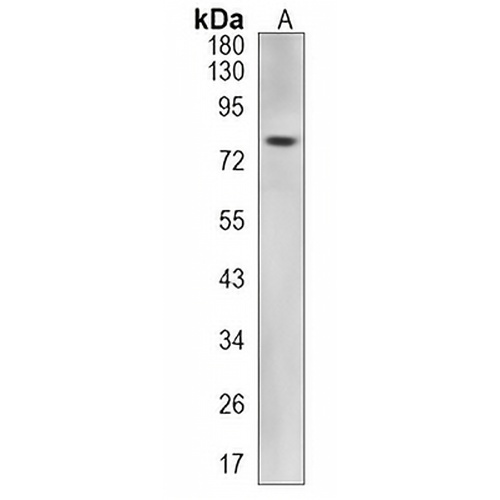 Androgen Receptor Rabbit Monoclonal Antibody(C1197)