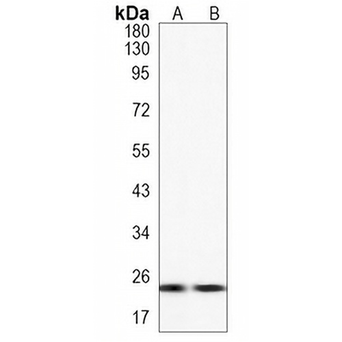 MRAS Rabbit Monoclonal Antibody(C1201)