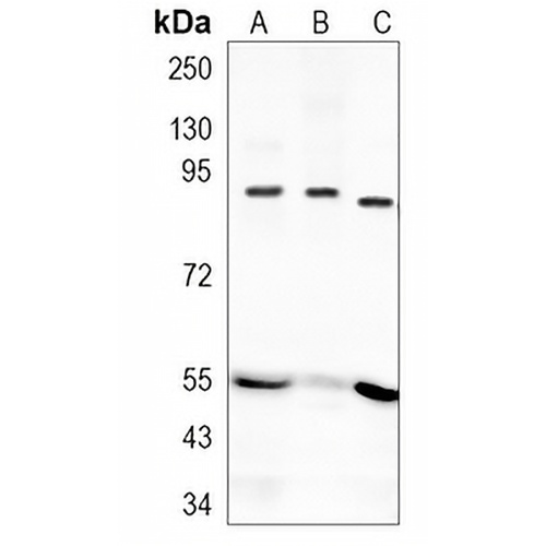 CD71 Rabbit Monoclonal Antibody(C1202)