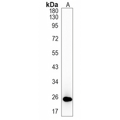 INMT Rabbit Monoclonal Antibody(C1204)