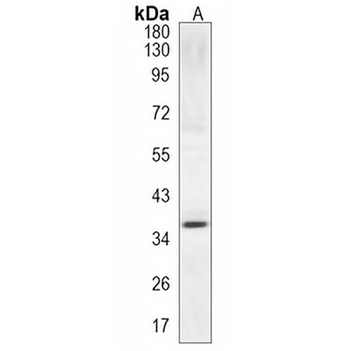 MYF5 Rabbit Monoclonal Antibody(C1205)