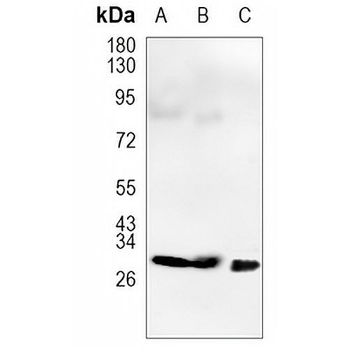 TPSAB1 Rabbit Monoclonal Antibody(C1207)