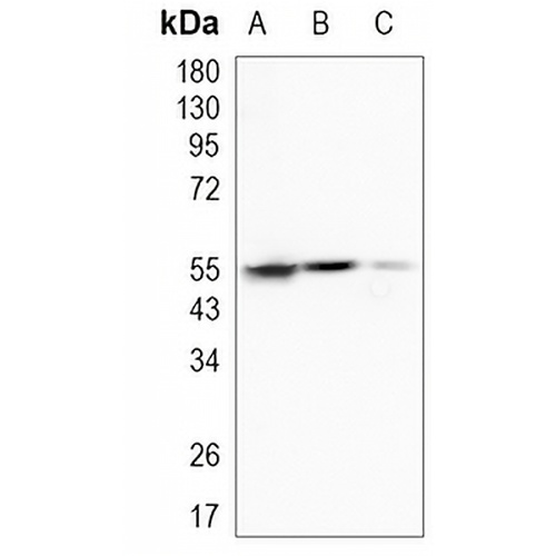 ALDH1A1 Rabbit Monoclonal Antibody(C1208)