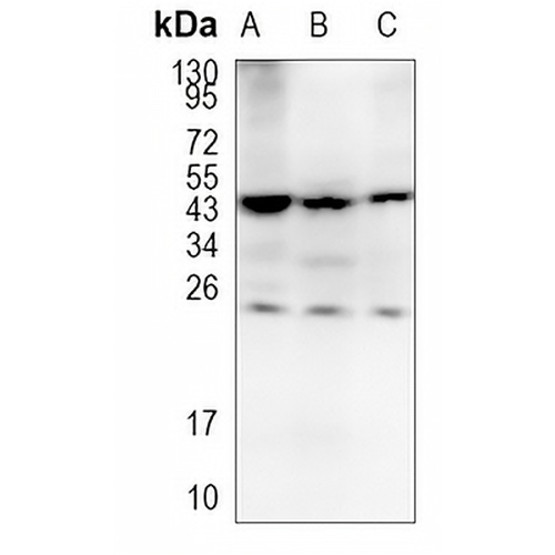 CSN1S1 Rabbit Monoclonal Antibody(C1209)